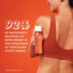 Bio-Oil Skincare Body Oil Seru... - Image 4