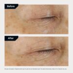 Revision Skincare D·E·J Eye Cr... - Image 7