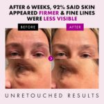 Eclat Skincare Anti Aging Face... - Image 4