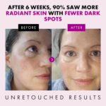 Eclat Skincare Anti Aging Face... - Image 5