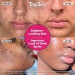 TruSkin Vitamin C Super Serum ... - Image 3