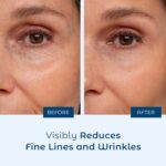 Hyaluronic Acid Serum for Skin... - Image 4